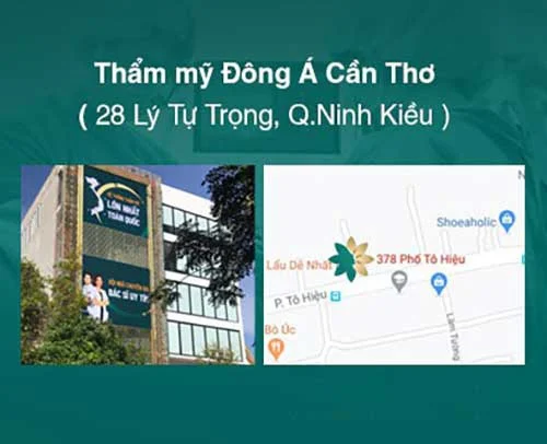 Thu gọn cánh mũi ở đâu an toàn tại cần thơ