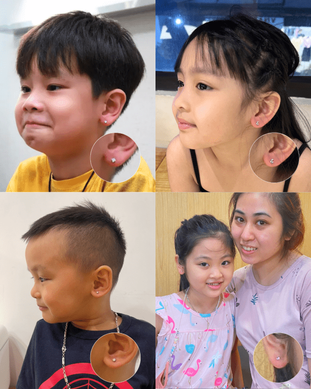 Xỏ khuyên cho bé HCM