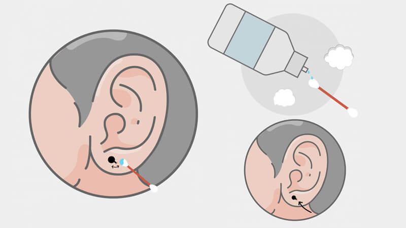 Bấm lỗ tai có đau không ?