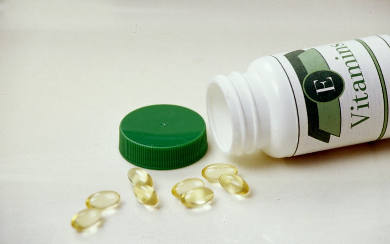 Cắt mí mắt uống vitamin e được không ?