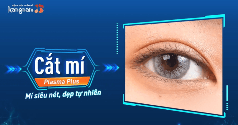 cắt mí mắt hcm