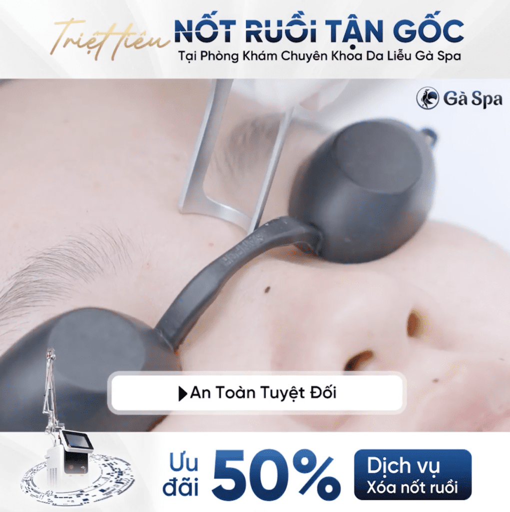 Địa chỉ xóa nốt ruồi hiệu quả nhất tại Long An