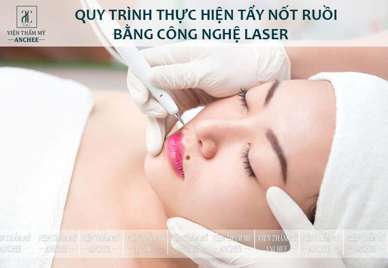 Địa chỉ xoá nốt ruồi hiệu quả nhất tại TPHCM