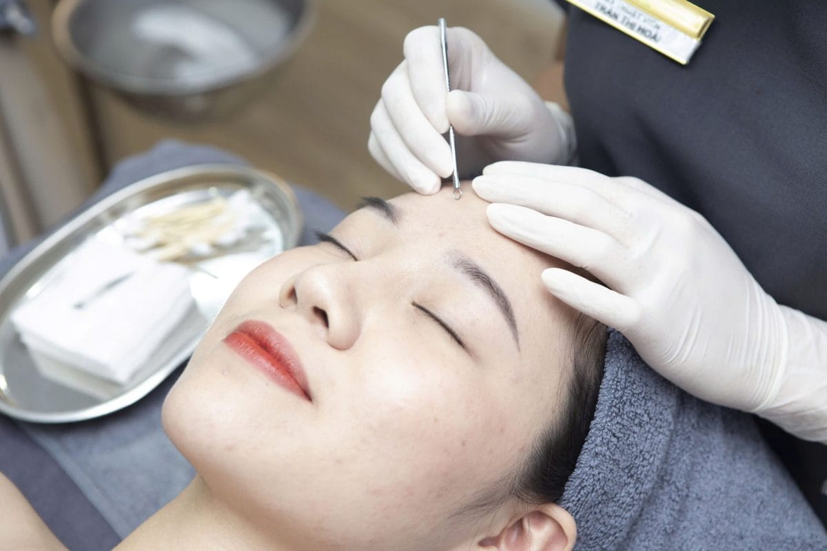 Điều trị mụn , mụn mủ , mụn trứng cá , mụn đầu đen hiệu quả tại long an