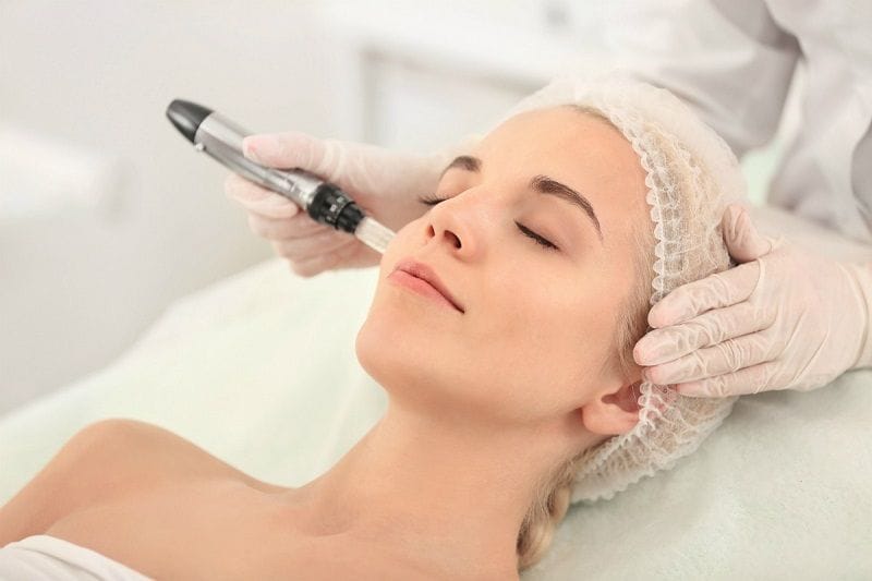 10 cách điều trị mụn ẩn cho da nhạy cảm vừa đơn giản vừa an toàn, hiệu quả