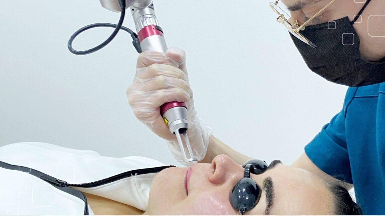trị mụn bằng laser