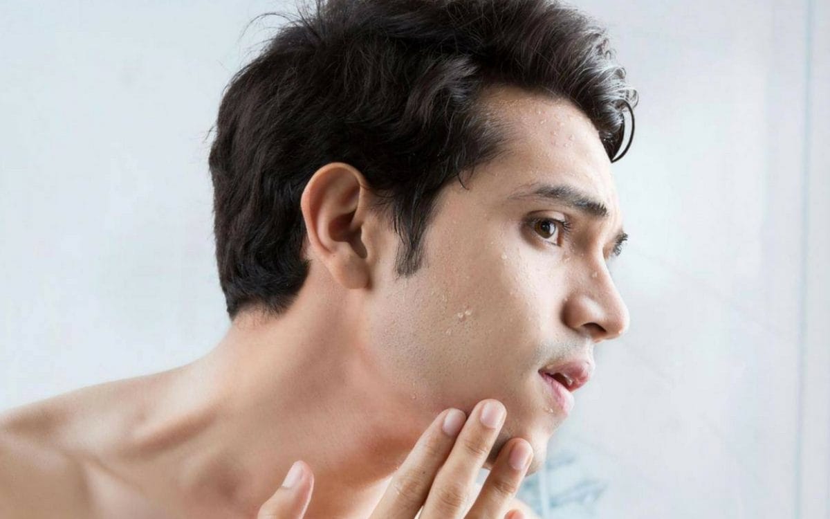 Điều trị mụn cho nam giới đơn giản, hiệu quả nhanh chóng