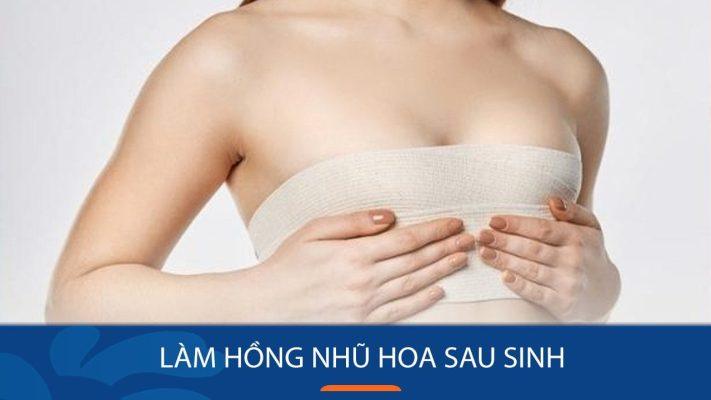 Làm hồng nhủ hoa sau sinh