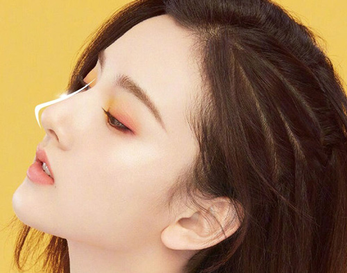 Nâng mũi sụn megaderm hcm