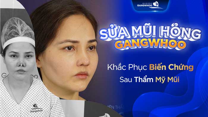 sửa mũi hỏng hcm