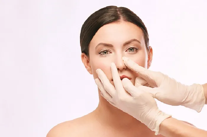 sửa mũi hỏng đã nâng trước đó hcm