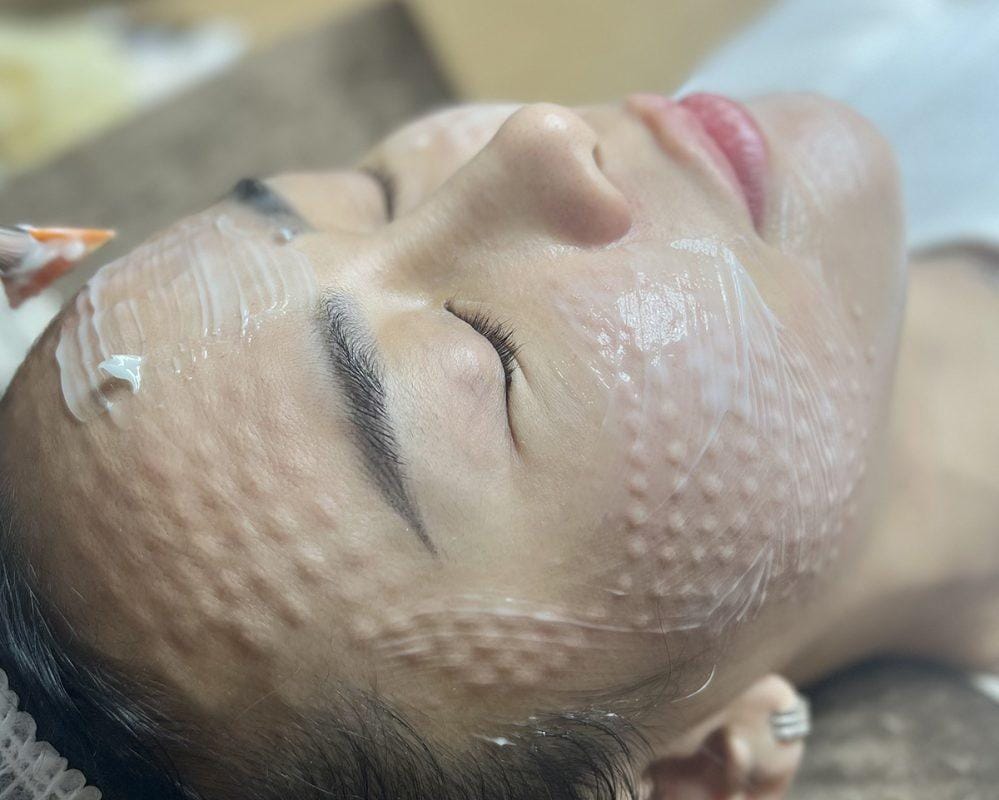 Địa chỉ tiêm meso đẹp Quận 8