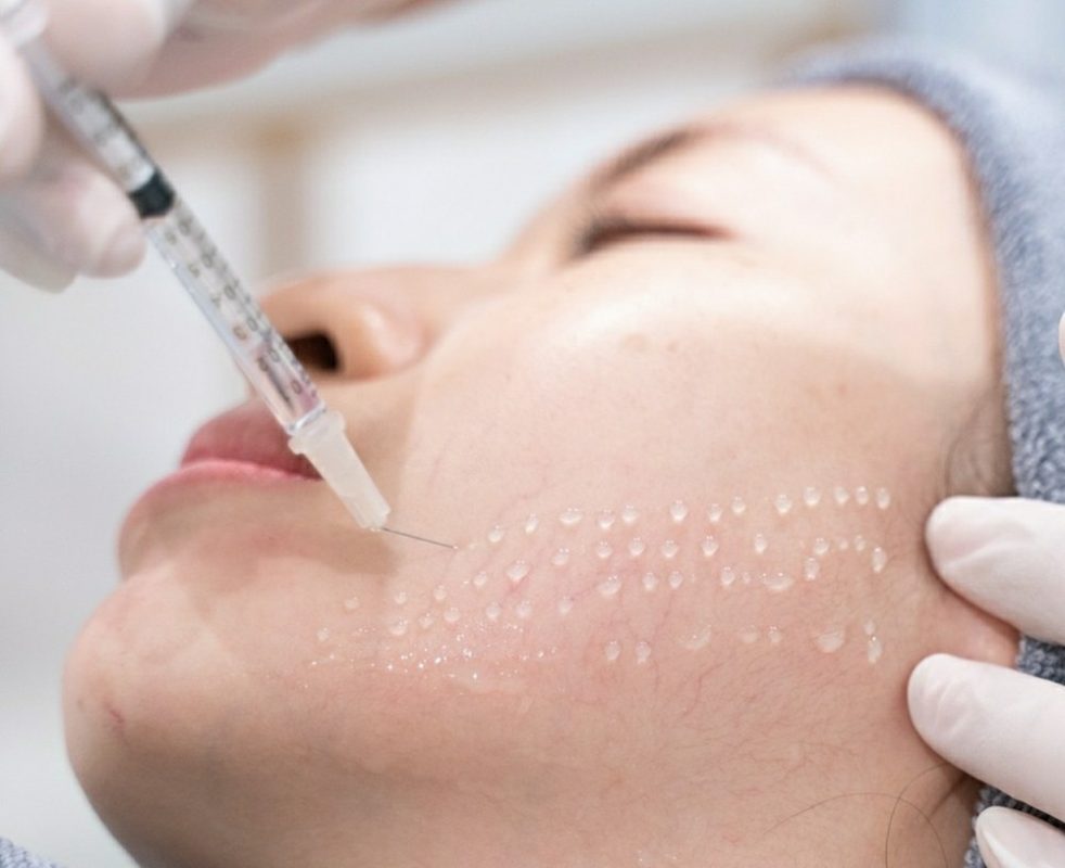 Địa chỉ tiêm meso đẹp Quận Tân Phú