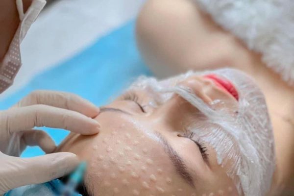 Địa chỉ tiêm meso đẹp Quận Tân Phú