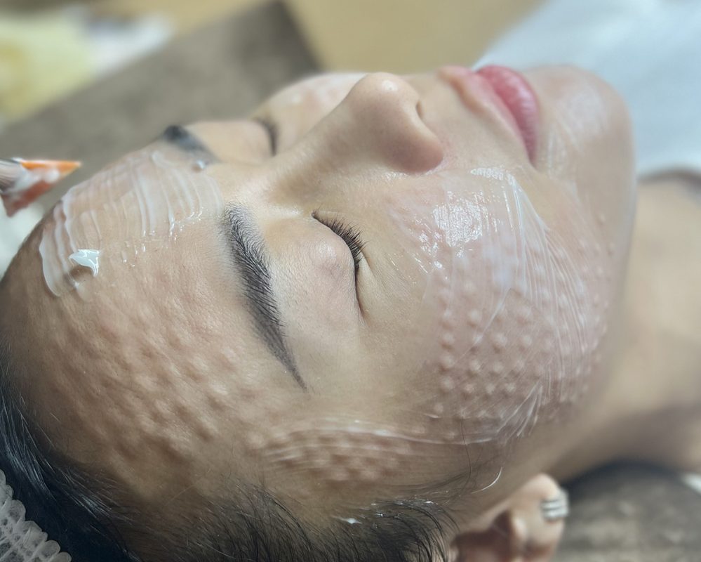 Địa chỉ tiêm meso đẹp Quận Tân Phú