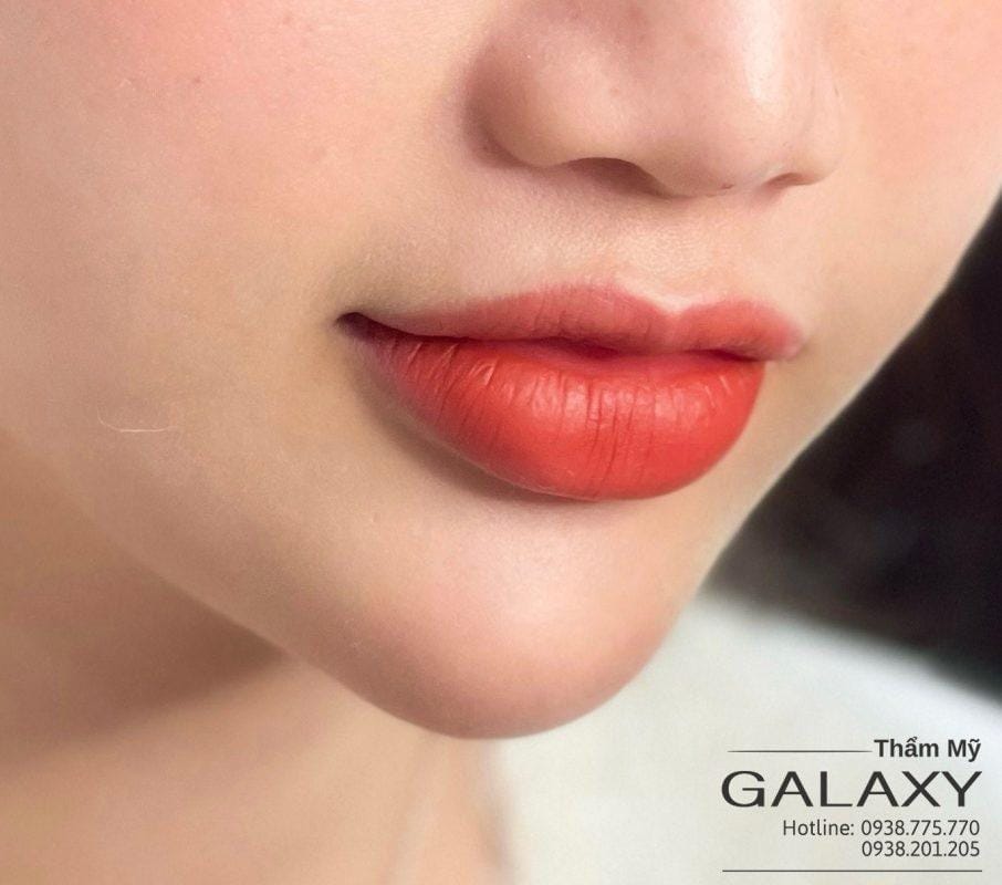 tiêm môi trái tim hcm