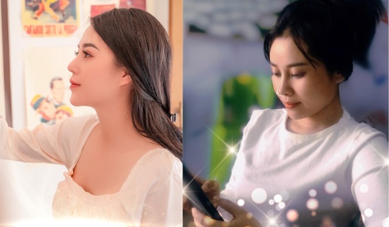 độn cằm hcm