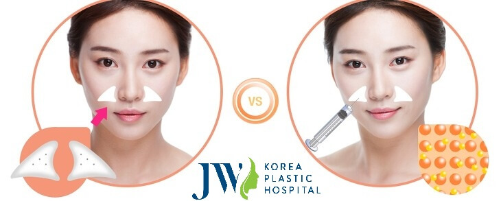 phẫu thuật xóa rãnh cười hcm