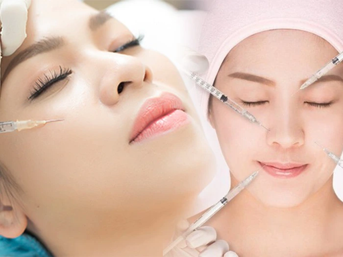 xóa rãnh cười tphcm