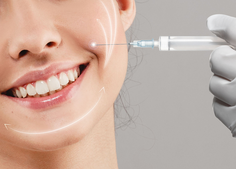 Xóa rãnh cười căng da mặt hcm