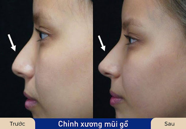 mài gồ mũi tphcm