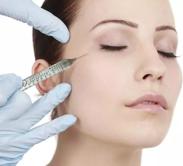 tiêm filler thái dương 