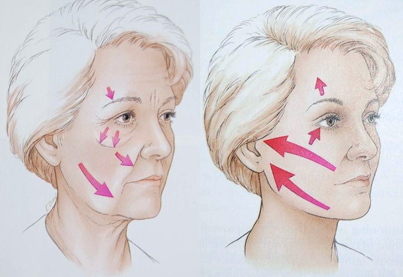 Căng da mặt bằng công nghệ Thermage TPHCM