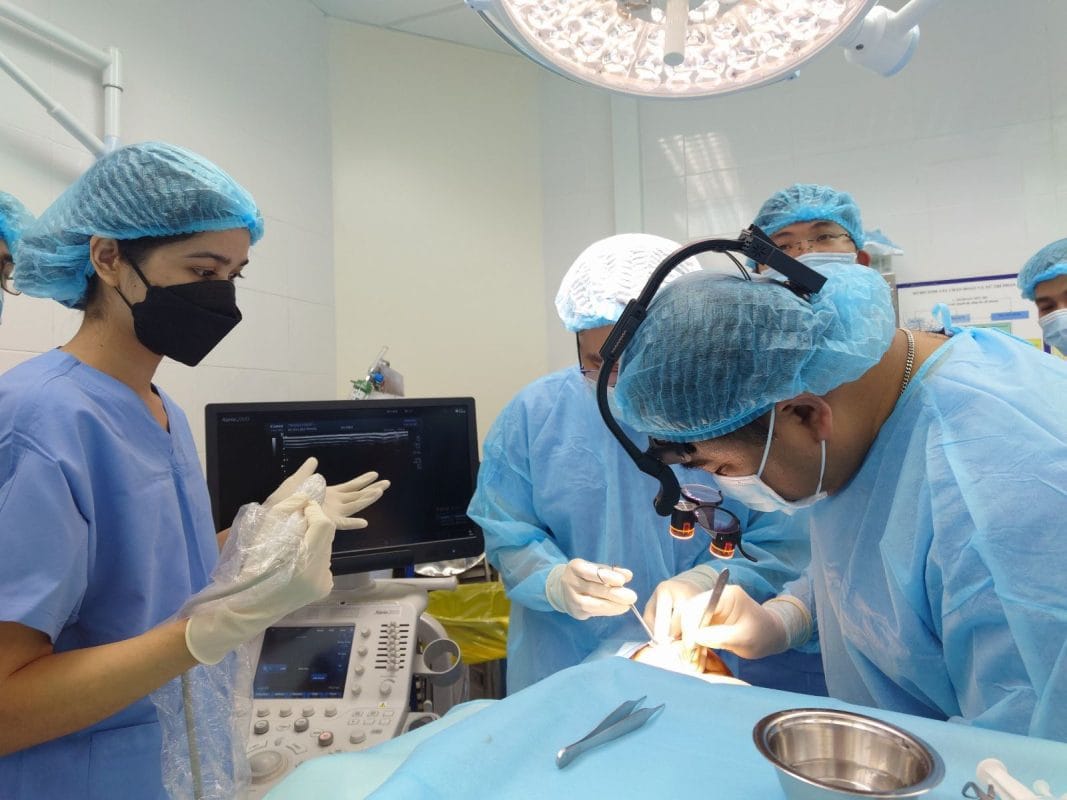 căng da mặt mini hcm