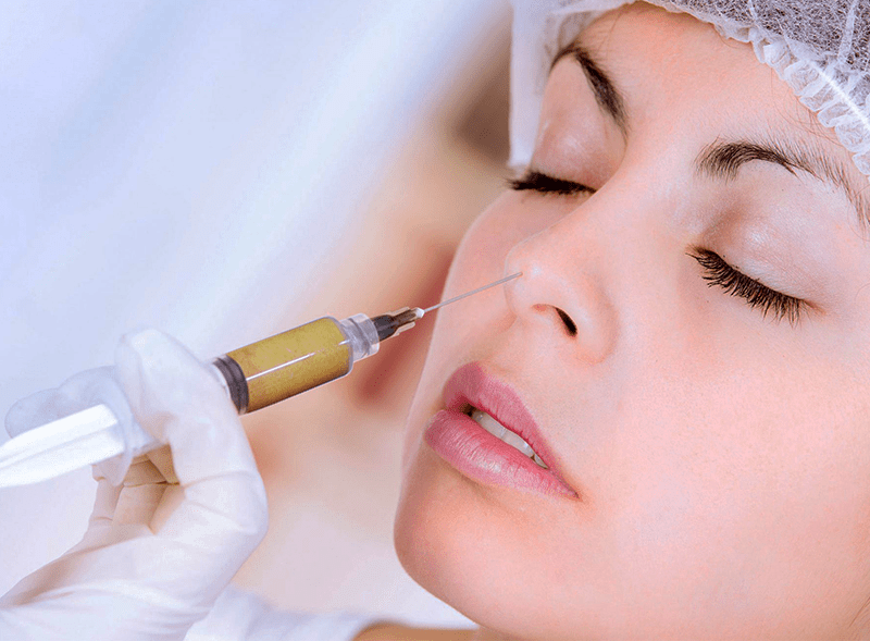 nâng mũi bằng mỡ tự thân hcm