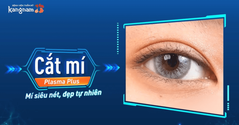 Cắt mí phượng hoàng hcm