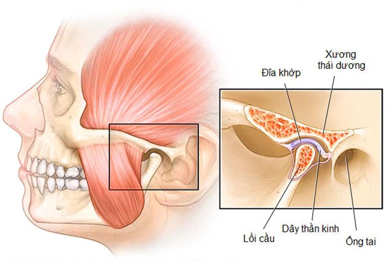 Nâng mũi bọc sụn cân cơ thái dương