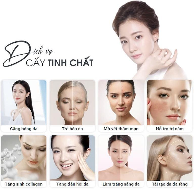 Địa chỉ tiêm Filler uy tín ở HCM