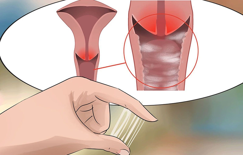 Nên điều trị bệnh lậu ở đâu tphcm