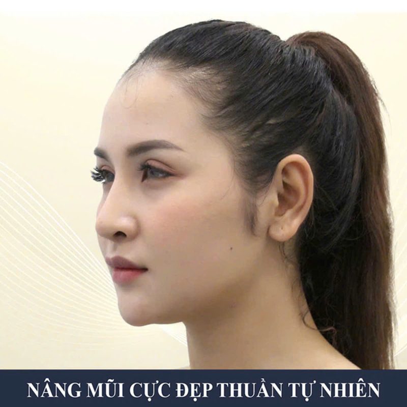 Bác sĩ nâng mũi đẹp nhất Việt Nam